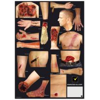 SET OP APPLICATIONS OF INJURIES, part 1